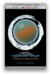AroundAndThrough.com [clinical 3D imaging services]